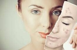 Aizstājot Botox